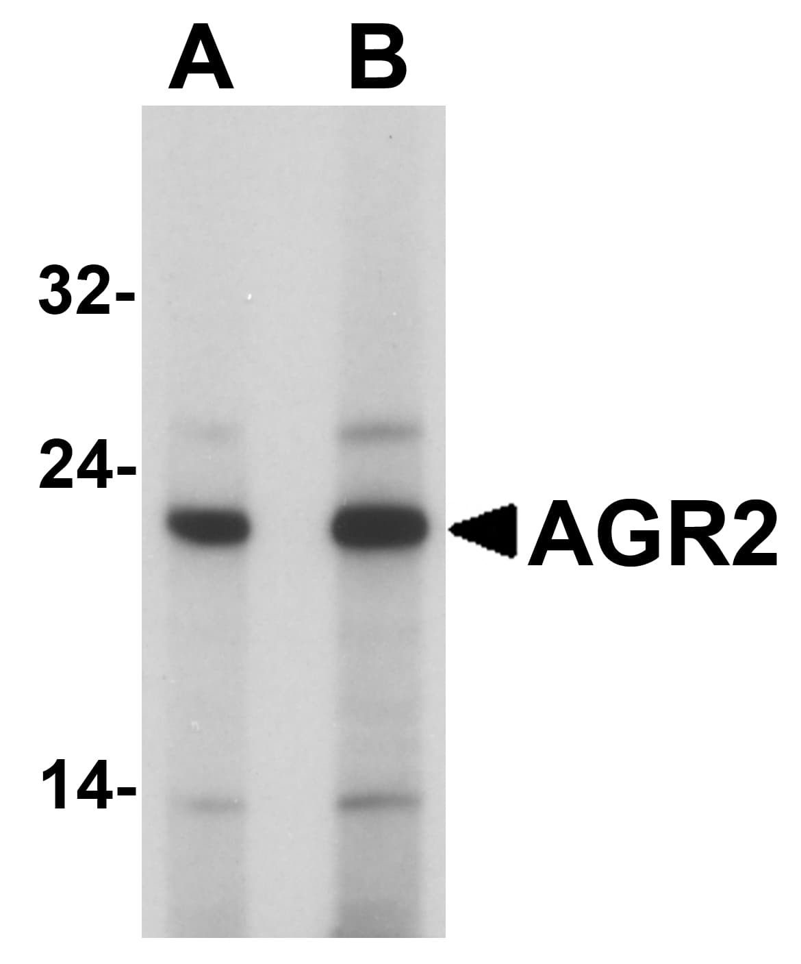PathPlus™ AGR2 Antibody