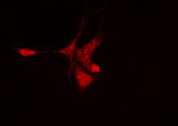 Polyclonal Rabbit anti-Human NR1I3 / CAR Antibody (IHC, IF, WB)