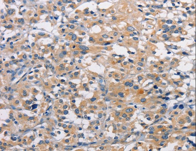 PRKCE / PKC-Epsilon Antibody