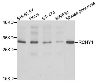 RCHY1 / PIRH2 Antibody