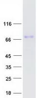 Human TAGAP Protein (Recombinant Myc-DDK (Flag))