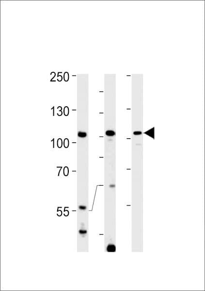 TFIP11 Antibody (aa42-70)