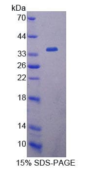 Human EIF4A1 Protein (Recombinant His-T7, N-terminus)