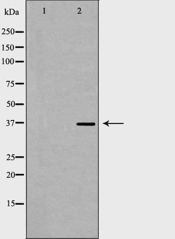 ACP5 / TRAP Antibody