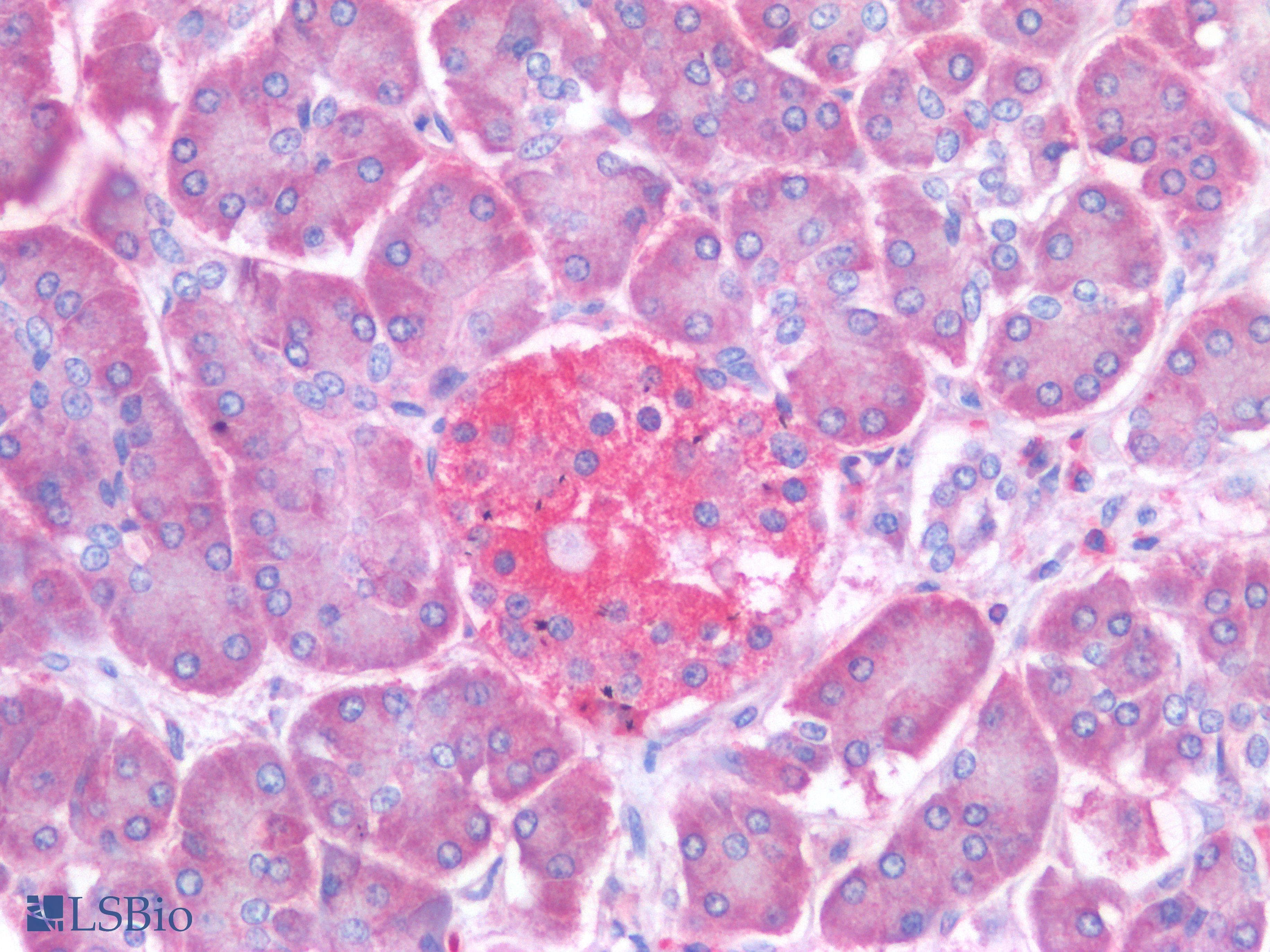 PathPlus™ PTP1B Antibody