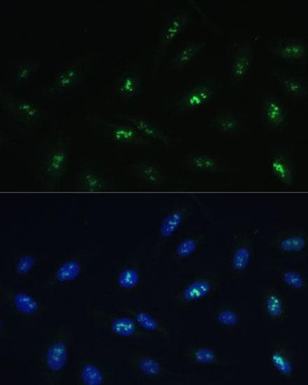 HNF4G / HNF4 Gamma Antibody