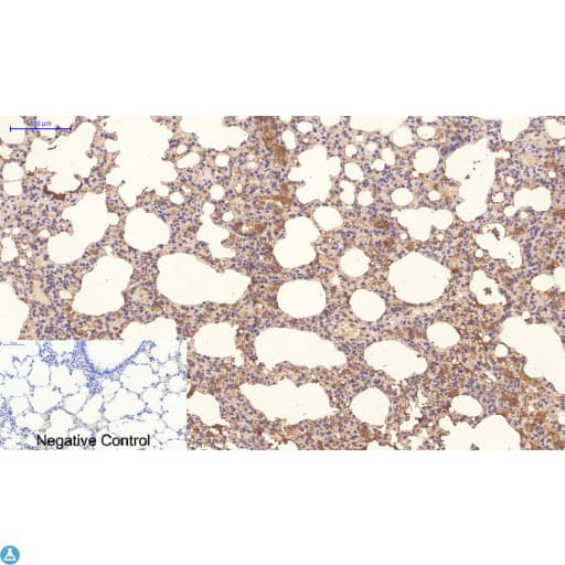 Monoclonal Mouse anti-Human NBR1 Antibody (WB)