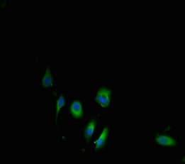 Polyclonal Rabbit anti-Mouse CBS Antibody