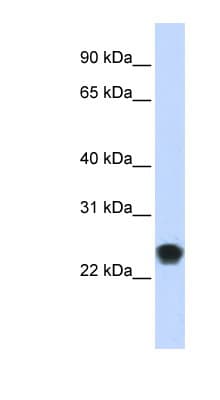 FKBP11 Antibody (aa35-84)