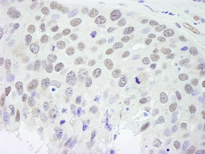 RBFOX2 / RBM9 Antibody (aa1-50)