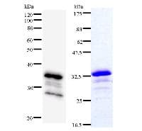 ACIN1 / Acinus Antibody (clone 2005C3a)