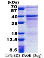 Human ZMAT3 Protein (Recombinant His)