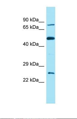 FAM111B Antibody (C-Terminus)