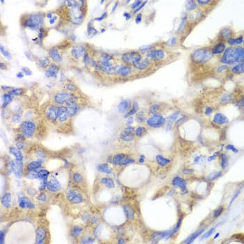 Polyclonal Rabbit anti-Human PNLIP / PL / Pancreatic Lipase Antibody (IHC, IF, WB)