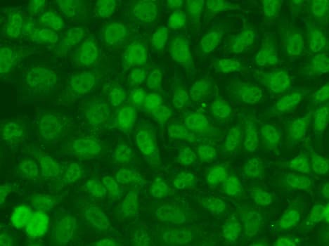 Polyclonal Rabbit anti-Human TSEN2 Antibody (IHC, IF, WB)