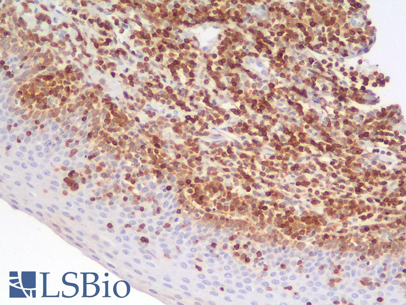PathPlus™ BCL2 / Bcl-2 Antibody (clone rBCL2/782)