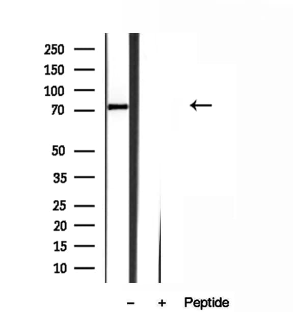 Polyclonal Rabbit anti-Human KIND2 / FERMT2 Antibody (IHC, WB)