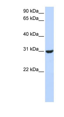 RNF182 Antibody (aa144-193)
