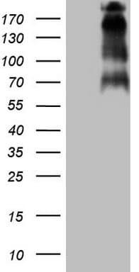 TP53BP1 / 53BP1 Antibody (aa1-300, clone OTI5E1)