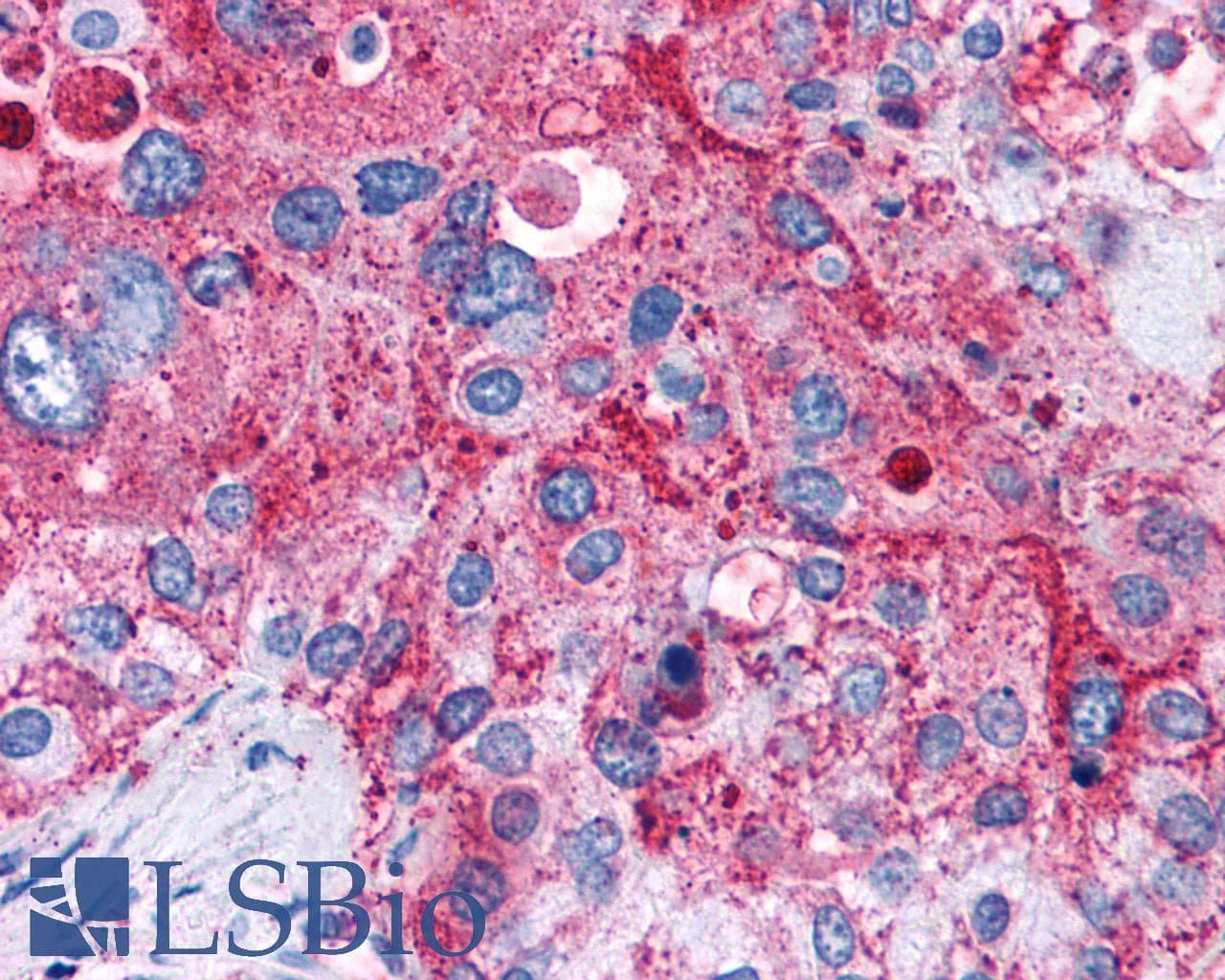 PathPlus™ GPR82 Antibody (Cytoplasmic Domain)