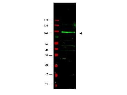 IHC-plus™ FBX09 / FBXO9 Antibody (aa425-447)