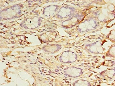 Polyclonal Rabbit anti-Human DYRK4 Antibody (IHC)