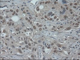 Monoclonal Mouse anti-Human ONECUT1 / HNF6 Antibody (clone OTI4F12, IHC, IF, WB)