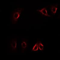 Polyclonal Rabbit anti-Human AXIN2 / Axin 2 Antibody (IF, WB)