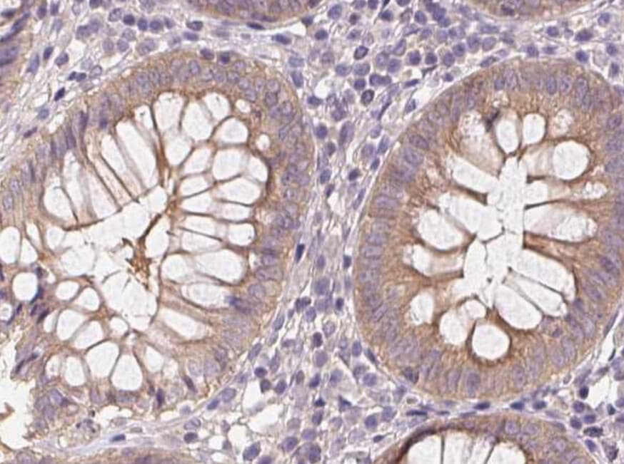 PRKAA1 / AMPK Alpha 1 Antibody (phospho-Thr172)