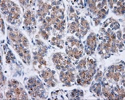 BTK Antibody (clone OTI12D4)