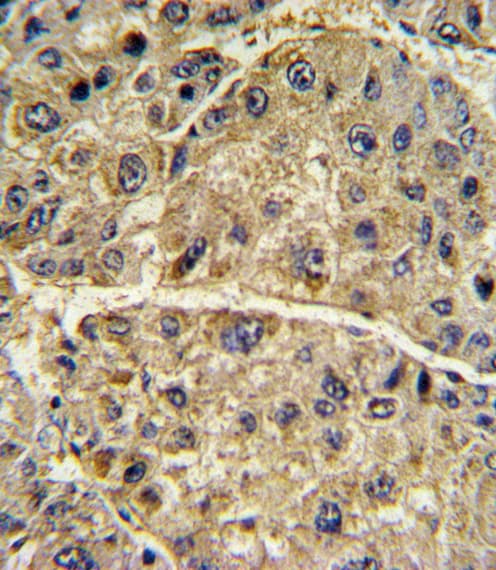 COL6A1 / Collagen VI Alpha 1 Antibody (aa48-77)