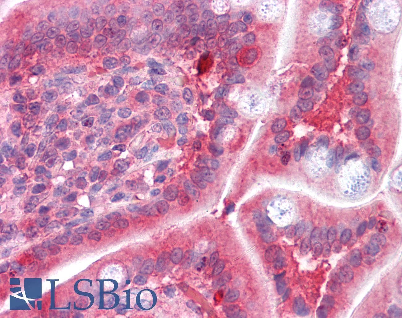IHC-plus™ Polyclonal Goat anti-Human COMT Antibody (aa170-183, IHC, WB)