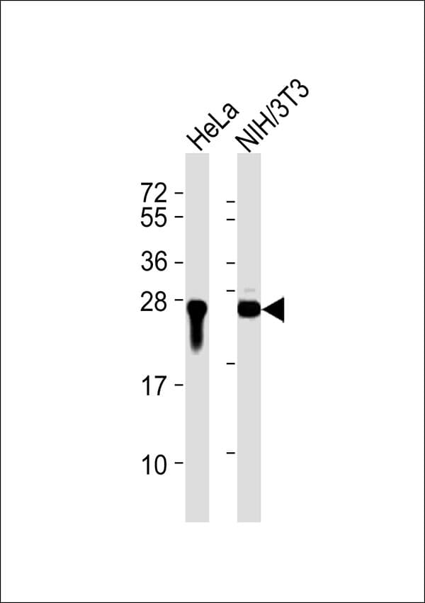 Polyclonal Rabbit anti-Human RAN Antibody (WB)