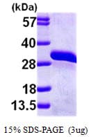 Human HAGH Protein (Recombinant His)