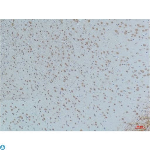 CaMKII Beta+Gamma+Delta Antibody (phospho-Thr287)