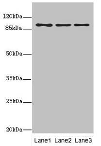 Polyclonal Rabbit anti-Human FTHFSDC1 / MTHFD1L Antibody (IHC, WB)