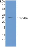GLUD1/Glutamate Dehydrogenase Antibody