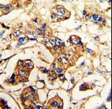ACTN4 Antibody (aa785-813)
