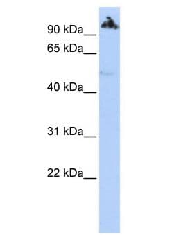 Polyclonal Rabbit anti-Human ZNF845 Antibody (aa691-740, WB)