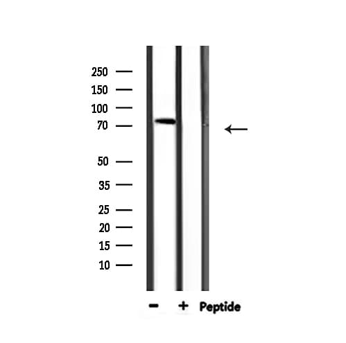 Polyclonal Rabbit anti-Human AKAP2 Antibody (IF, WB)