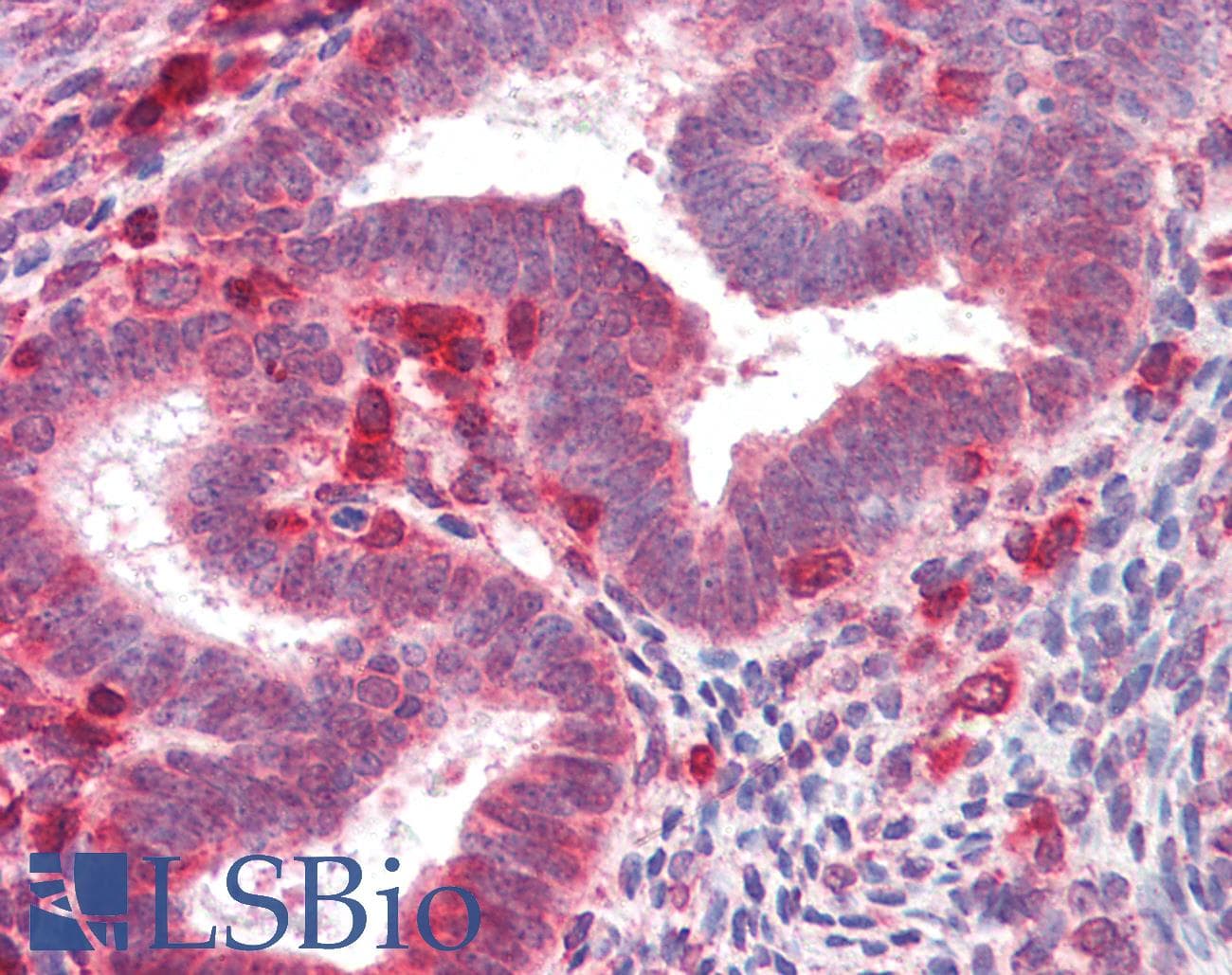 IHC-plus™ FGFR4 Antibody (clone 53CT32.19.3)