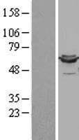 DLD / Diaphorase / E3 Protein (Over-Expression Lysate Myc-DDK (Flag))