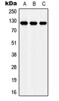 APOER2 / LRP8 Antibody (Internal)