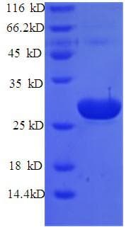 Mouse TPT1 / TCTP Protein (Recombinant His)