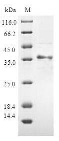 Human ATP5J Protein (Recombinant GST, N-terminus)
