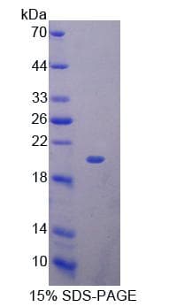 Mouse KLRK1 / CD314 / NKG2D Protein (Recombinant 6His, N-terminus)