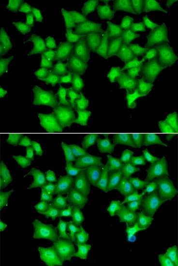 Polyclonal Rabbit anti-Human CPSF3L Antibody (IHC, IF, WB)