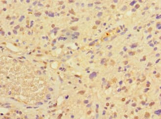 Polyclonal Rabbit anti-Human PRMT3 Antibody (IHC, IF, WB)
