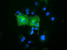OSBPL11 Antibody (clone OTI10F6, Carrier-free)