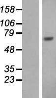 Human ALB / Serum Albumin Protein (Over-Expression Lysate Myc-DDK (Flag))